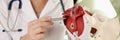 Female doctor holds in her hands model of female pelvis with muscles and pen.