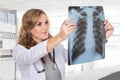 Female doctor looking at a lungs or torso xray