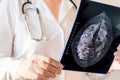 Female doctor looking at mammography results on x-ray Royalty Free Stock Photo