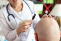 Female doctor looks at skin of bald patient through magnifying glass. Royalty Free Stock Photo