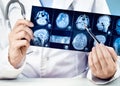 Female doctors hand pointing at x-ray medical imaging at a head checks