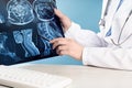 Female doctors hand pointing at x-ray medical imaging at a shoulder condition