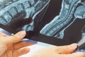 Female doctors hand pointing at x-ray medical imaging at a shoulder condition Royalty Free Stock Photo