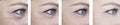 Female elderly  eyes  wrinkles before difference after lifting correction procedures Royalty Free Stock Photo