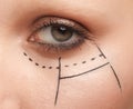 Female eye area with perforation lines, platic surgery Royalty Free Stock Photo