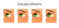 Female eye and the process of growth of eyelashes