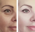 Female eye wrinkles before and after lift effect difference correction procedures Royalty Free Stock Photo