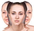 Female face before and after facial rejuvenation Royalty Free Stock Photo