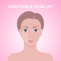 Female face with marks arrow lines on skin for cosmetic medical procedures facial lift reduction treatment skincare