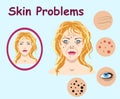 Female face skin problems. Vector illustration for cosmetic Royalty Free Stock Photo