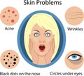 Female face skin problems. Vector illustration for cosmetic Royalty Free Stock Photo