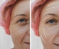 Female facial wrinkles treatment before and after cosmetic procedures, arrow Royalty Free Stock Photo