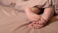 female feet, cracks, calluses under the covers, unkempt heels barefoot, burrs close dry, female heels. Leg ointment pain