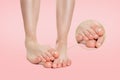 Female feet placed one on top of the other, with nail fungus disease. Zoomed image of the haelthy nails. Pink background. Concept