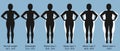 Female figures with normal weight, overweight and obesity Royalty Free Stock Photo