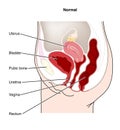 Female genitourinary