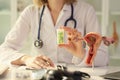 Female gynecologist shows medical pills and model of female reproductive system.