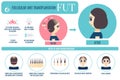 FUT hair transplantation for women