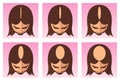 Female hair loss illustration