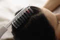 On female hair there is device for restoration of hair follicles Royalty Free Stock Photo