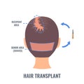 Female hair treatment with FUE transplantation method