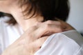 Female hand scratch itchy skin on his shoulder. Royalty Free Stock Photo