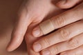 Female hands with a medical plaster on finger Royalty Free Stock Photo