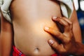 Female hands used by patients with mosquito repellant Royalty Free Stock Photo