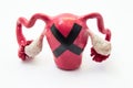 Female infertility concept. Model of female uterus with ovaries with black prohibiting cross on it. Photo symbolizing female infer Royalty Free Stock Photo