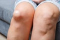 Female injured knee