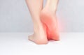 Female legs and feet on a white background that hurt and itch because of fungus, close-up, copy space, dermatitis