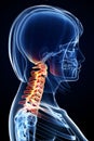 Female Neck pain Anatomy Royalty Free Stock Photo