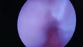 Female neck of uterus womb cervix uteri on monitor gynecological examination.