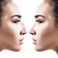 Female nose before and after cosmetic surgery. Royalty Free Stock Photo