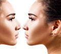 Female nose before and after cosmetic surgery. Royalty Free Stock Photo