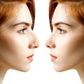 Female nose before and after cosmetic surgery.