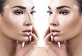 Female nose before and after cosmetic surgery. Royalty Free Stock Photo