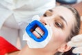 Female patient undergoing teeth whitening procedure Royalty Free Stock Photo