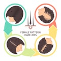 Female pattern baldness four steps infographics template