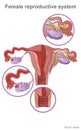 The female reproductive system contains two main parts: the uterus, which hosts the developing fetus, produces vaginal and