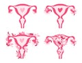 Female reproductive system set. Hand drawn uterus, womb female reproductive sex organ and flowers. The uterus is
