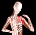 Female skeleton with shoulder pain Royalty Free Stock Photo