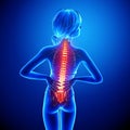 Female spine pain