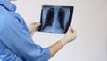 Female therapist analyzing lungs x-ray, patient examination result, diagnosis