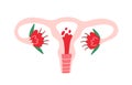 Female uterus with menstrual blood inside and flowers. Womb organ during menstruation. Women reproductive system and