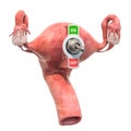 Female uterus with toggle switch. Female infertility or climacteric concept, 3D rendering