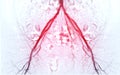 Femoral artery angiogram or angiography