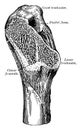 Femoral Spur of the Femur, vintage illustration