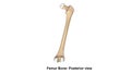 Femur bone Posterior view