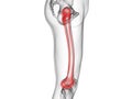 The femur